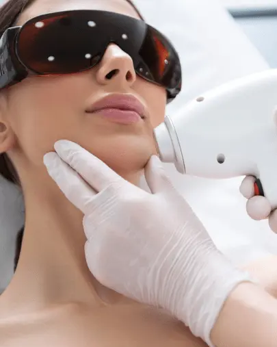 Dauerhafte Laser-Haarentfernung bei Laser Angel